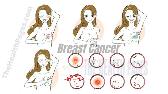 Breast Cancer: The Health Pages