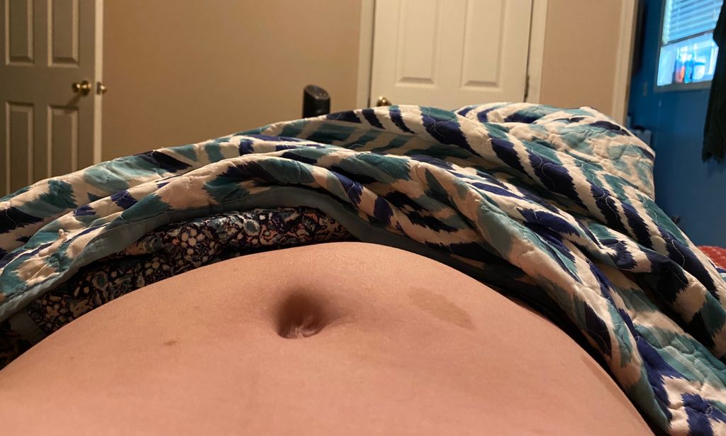 Lopsided stomach