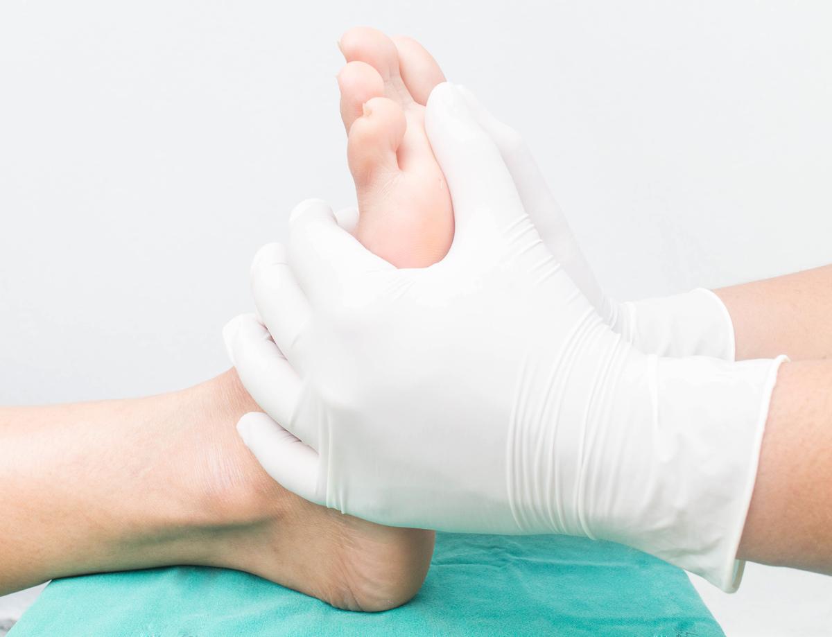 Effective Strategies to Treat Diabetic Neuropathy A Comprehensive Guide